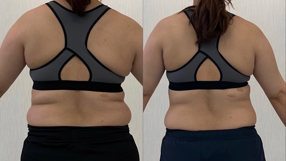 鹿児島市 パーソナルジム 無料体験 ビフォーアフター 3ヶ月で-4kg達成！ Cさん様